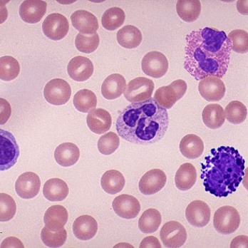 Hematology