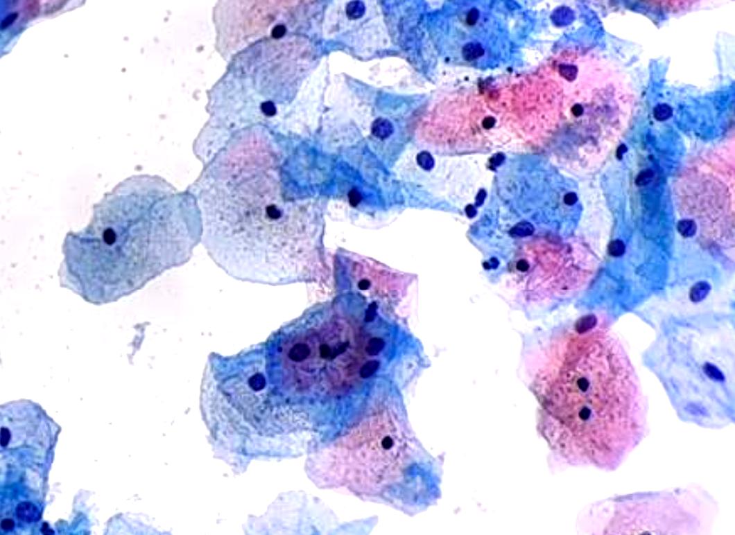 Pap Smear