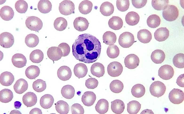 Hematology