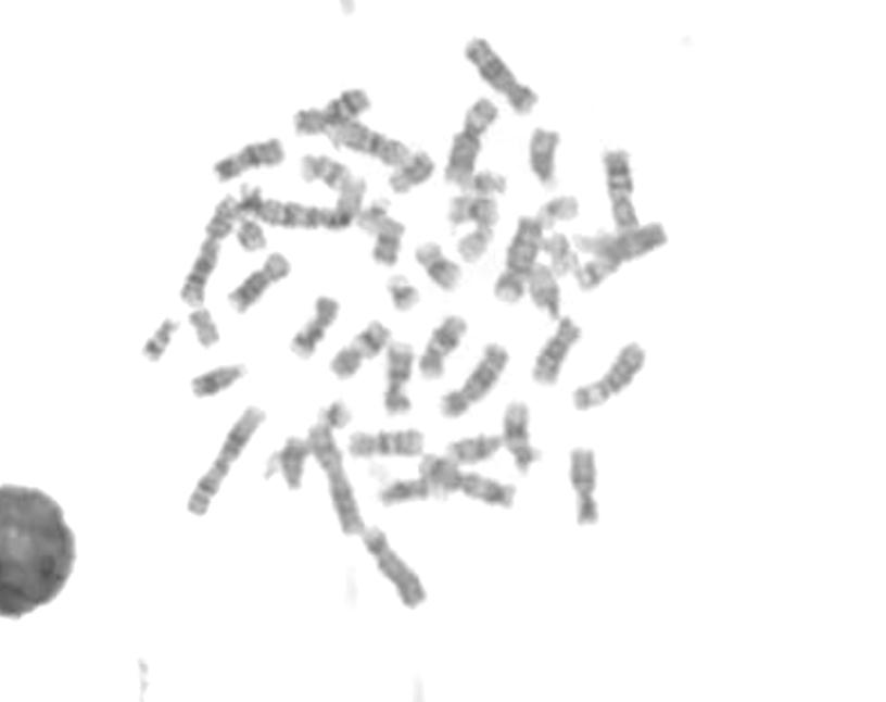 Karyotyping