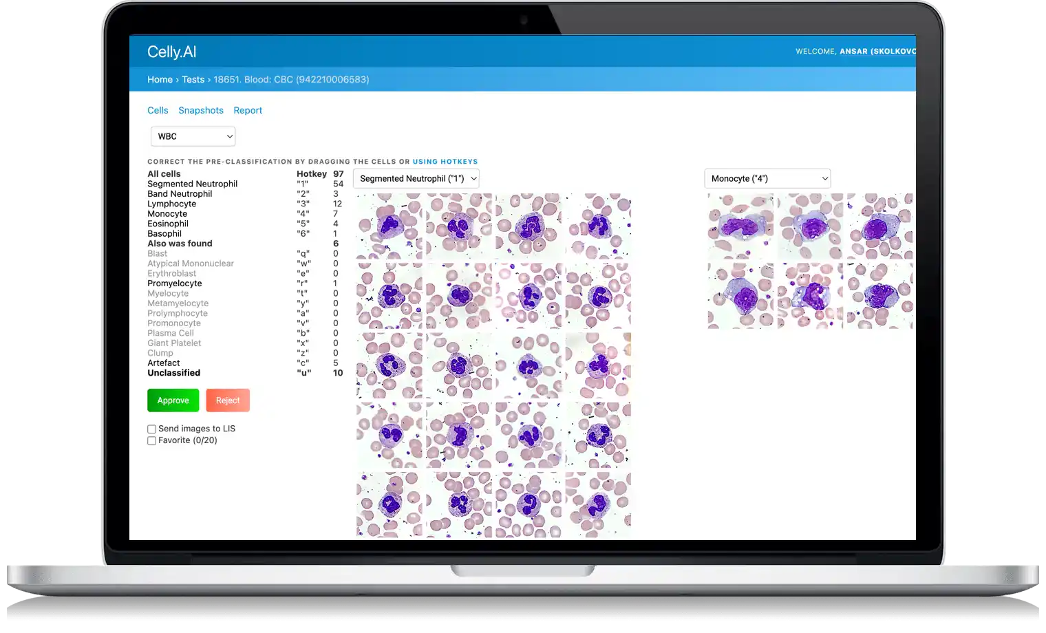Celly web interface demo